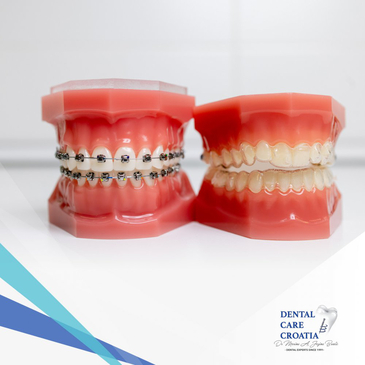Slider image (3) Dental Care Croatia
